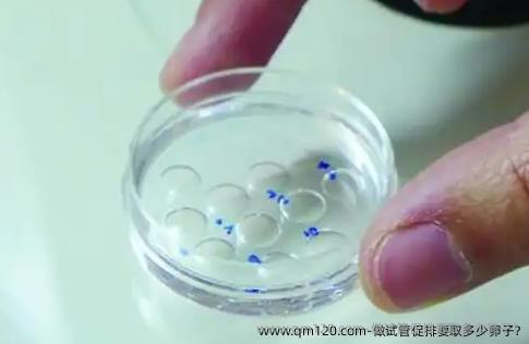 做试管促排要取多少卵子?
