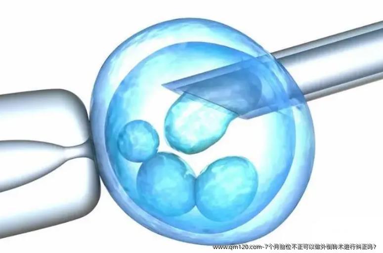 7个月胎位不正可以做外倒转术进行纠正吗？