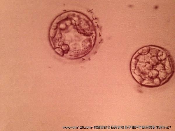 抗磷脂综合征患者在备孕和怀孕期间需要注意什么？