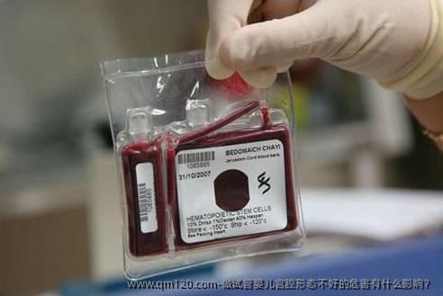 做试管婴儿宫腔形态不好的危害有什么影响?