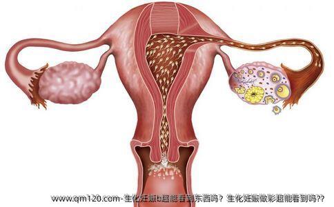 生化妊娠b超能看到东西吗？生化妊娠做彩超能看到吗?？