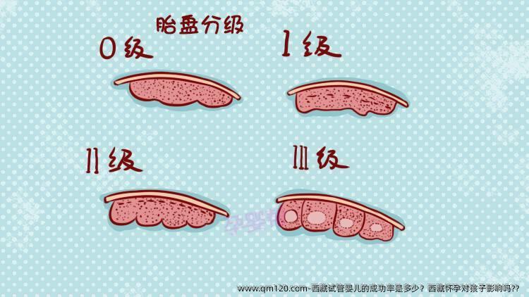 西藏试管婴儿的成功率是多少？西藏怀孕对孩子影响吗?？