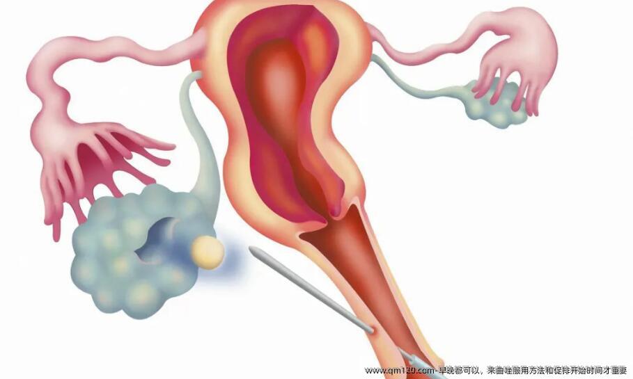 早晚都可以，来曲唑服用方法和促排开始时间才重要