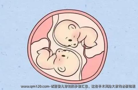 试管婴儿穿刺的步骤汇总，这些手术风险大家有必要知道