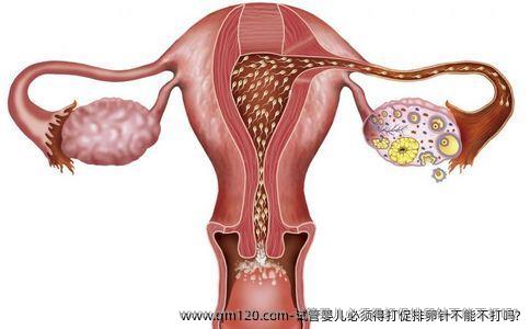 试管婴儿必须得打促排卵针不能不打吗?