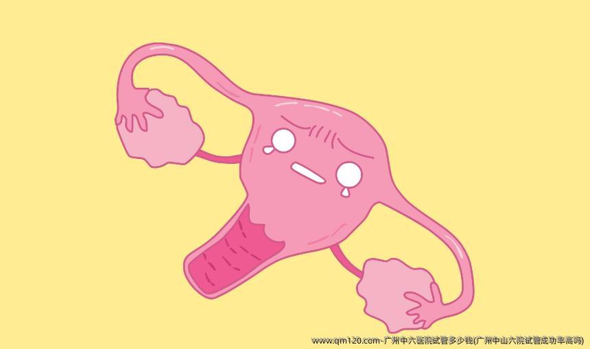 广州中六医院试管多少钱(广州中山六院试管成功率高吗)