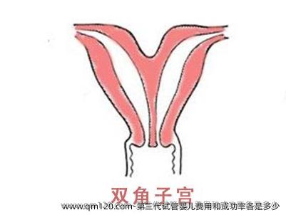第三代试管婴儿费用和成功率各是多少