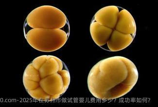 2025年在苏州市做试管婴儿费用多少？成功率如何？