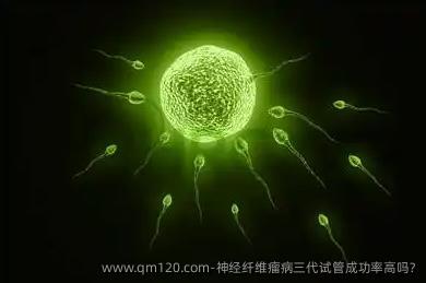 神经纤维瘤病三代试管成功率高吗?