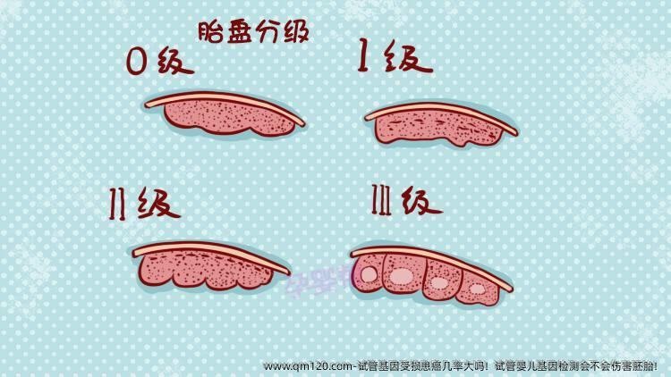 试管基因受损患癌几率大吗！试管婴儿基因检测会不会伤害胚胎！