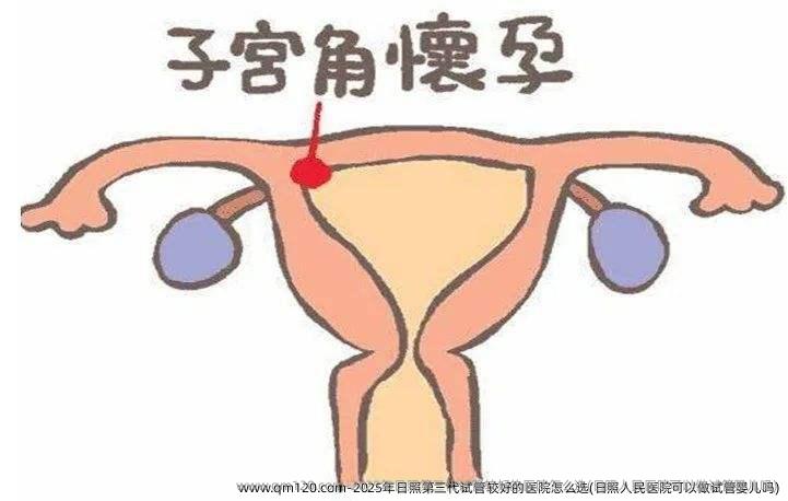 2025年日照第三代试管较好的医院怎么选(日照人民医院可以做试管婴儿吗)