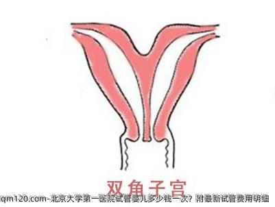 北京大学第一医院试管婴儿多少钱一次？附最新试管费用明细