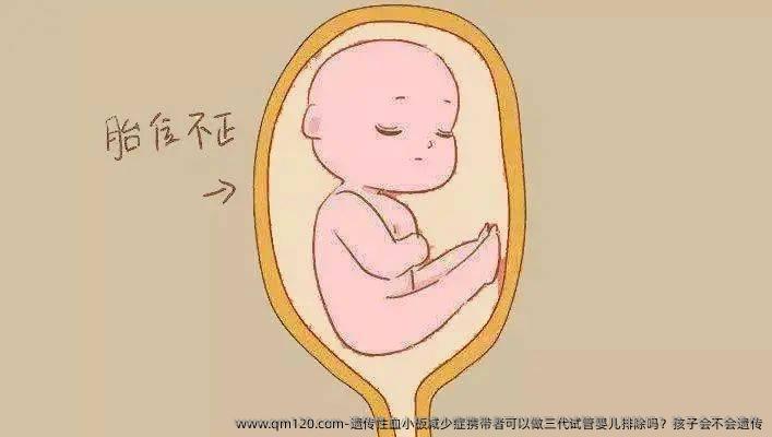 遗传性血小板减少症携带者可以做三代试管婴儿排除吗?孩子会不会遗传