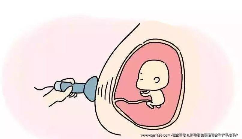 做试管婴儿前需要去医院登记孕产历史吗？
