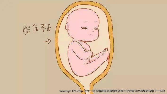郑大一附院给脊椎肌萎缩患者做三代试管可以避免遗传给下一代吗