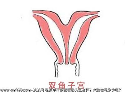 2025年在原平市做试管婴儿怎么样？大概要花多少钱？
