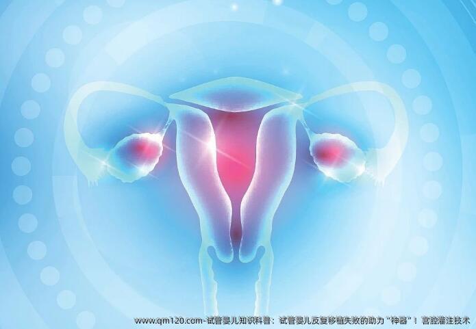 试管婴儿知识科普：试管婴儿反复移植失败的助力“神器”！宫腔灌注技术