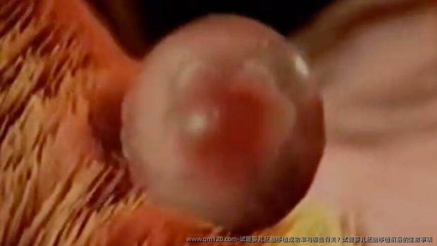 试管婴儿胚胎移植成功率与哪些有关？试管婴儿胚胎移植前后的注意事项