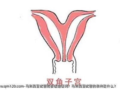 马来西亚试管需要结婚证吗？马来西亚试管的条件是什么？