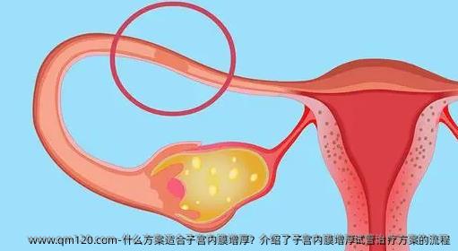 什么方案适合子宫内膜增厚？介绍了子宫内膜增厚试管治疗方案的流程