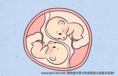 昆明进行第三代试管婴儿的基本花费！