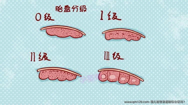婴儿能想要超雄综合征吗？