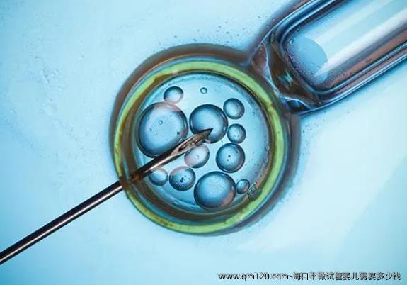 海口市做试管婴儿需要多少钱