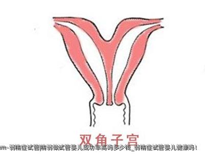 弱精症试管|精弱做试管婴儿成功率高吗多少钱_弱精症试管婴儿健康吗！