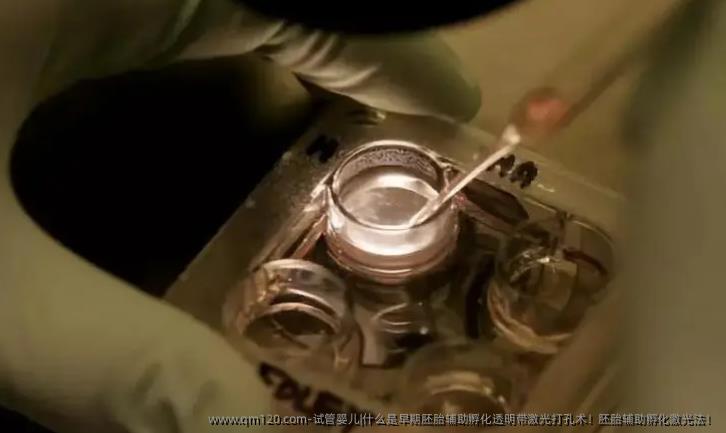 试管婴儿|什么是早期胚胎辅助孵化透明带激光打孔术！胚胎辅助孵化激光法！