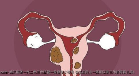 哈尔滨做一代二代三代试管一般要多少费用,哈尔滨医大一院可以做三代试管婴儿吗！