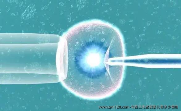 华西三代试管婴儿需多少费用