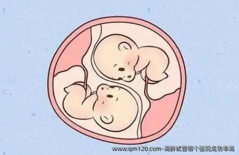 高龄试管哪个医院成功率高