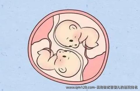 云南做试管婴儿的医院排名