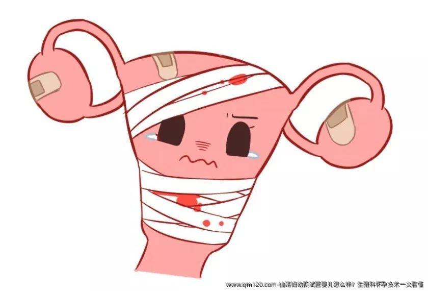 曲靖妇幼院试管婴儿怎么样？生殖科怀孕技术一文看懂