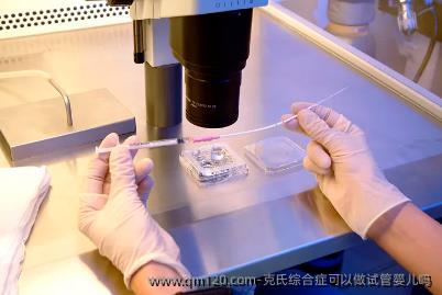 克氏综合症可以做试管婴儿吗