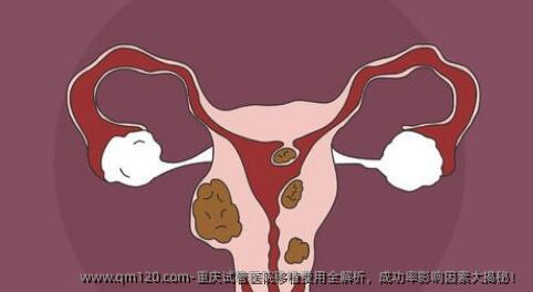 重庆试管医院移植费用全解析，成功率影响因素大揭秘！