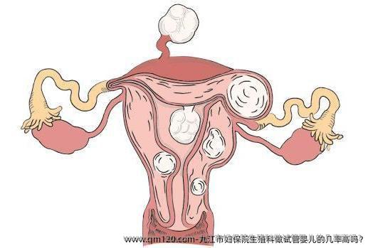 九江市妇保院生殖科做试管婴儿的几率高吗？