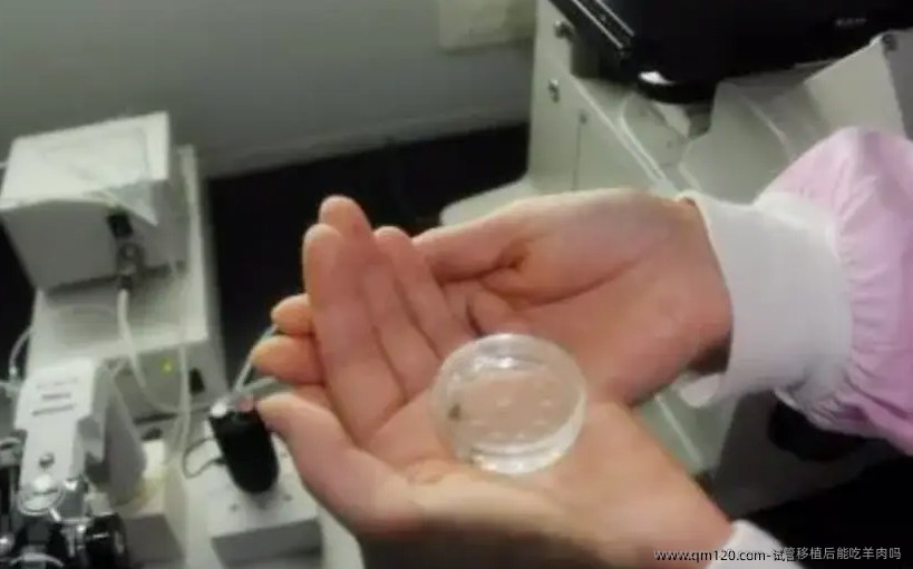 试管移植后能吃羊肉吗