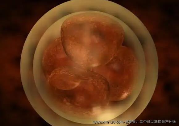 试管婴儿是否可以选择顺产分娩