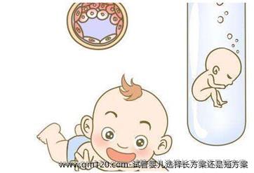 试管婴儿选择长方案还是短方案