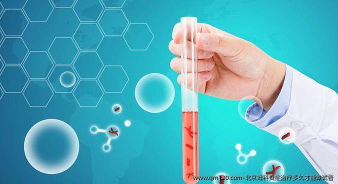 北京妇科炎症治疗多久才能做试管