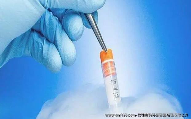 女性患有外阴白斑后应该怎么办