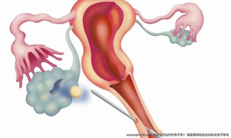 中医如何治疗女性不孕？ 雌激素样物质会导致女性不孕吗