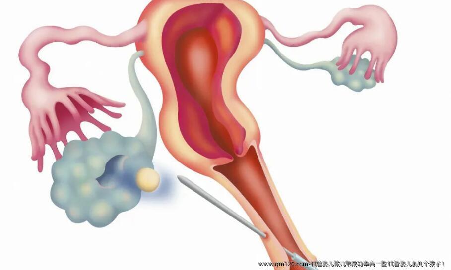 试管婴儿做几带成功率高一些 试管婴儿要几个孩子！