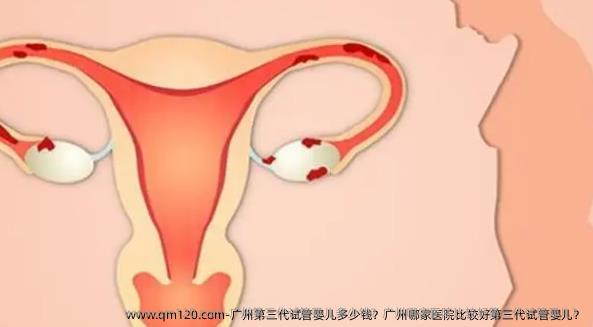 广州第三代试管婴儿多少钱？广州哪家医院比较好第三代试管婴儿？