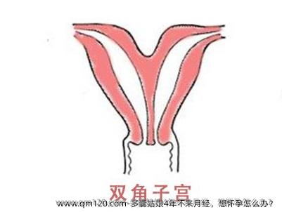 多囊姑娘4年不来月经，想怀孕怎么办？