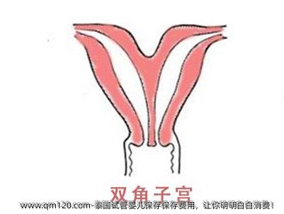 泰国试管婴儿保存保存费用，让你明明白白消费！