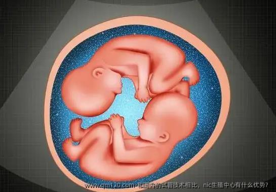 和国内的试管技术相比，nic生殖中心有什么优势？