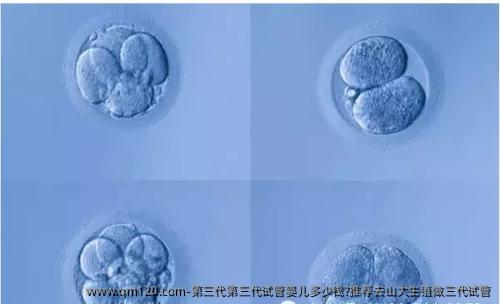 第三代第三代试管婴儿多少钱?推荐去山大生殖做三代试管