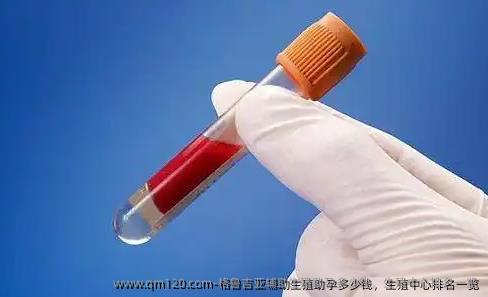 格鲁吉亚辅助生殖助孕多少钱，生殖中心排名一览